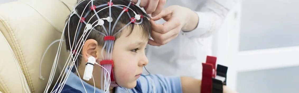 Ээг детям нижний новгород. ЭЭГ головного мозга. Эхо ЭГ Эхо энцефалограмма. Реоэнцефалография у детей. ЭЭГ детям.