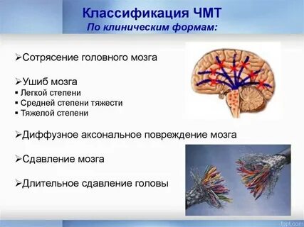 Черепно давления