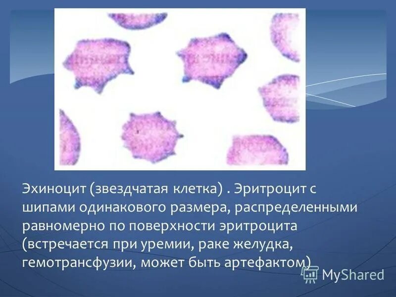 Эхиноциты