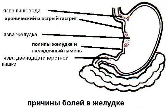 Быстрые боли в желудке