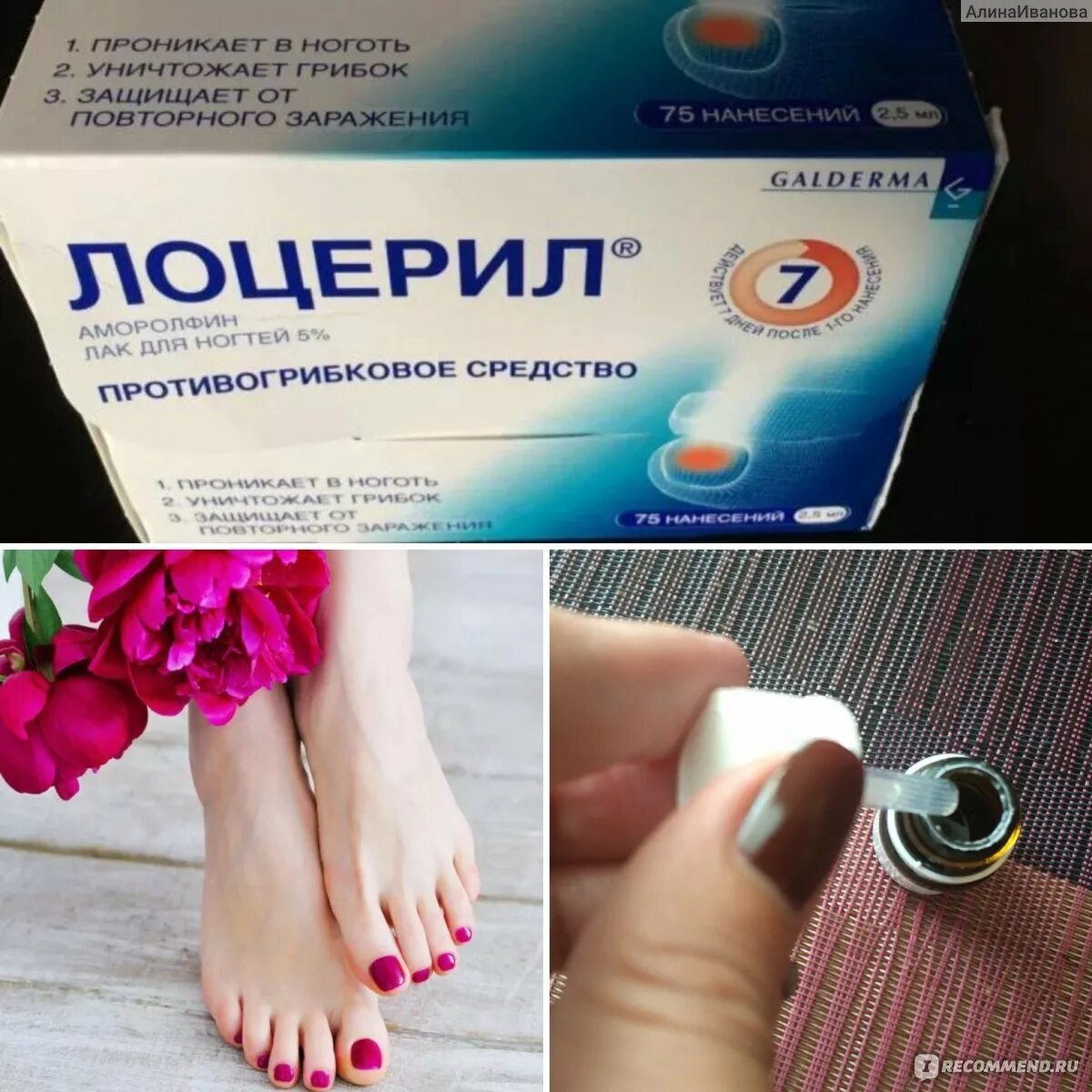 Средство против грибка стопы. Средство от грибка ногтей. Средство от грибка ногтей лекарства. Лекарство мазь от грибка ног. Противогрибковое средство для ногтей на ногах.