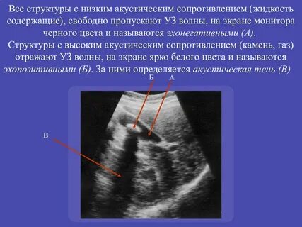 Акустический импеданс это