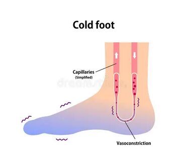 Having cold feet