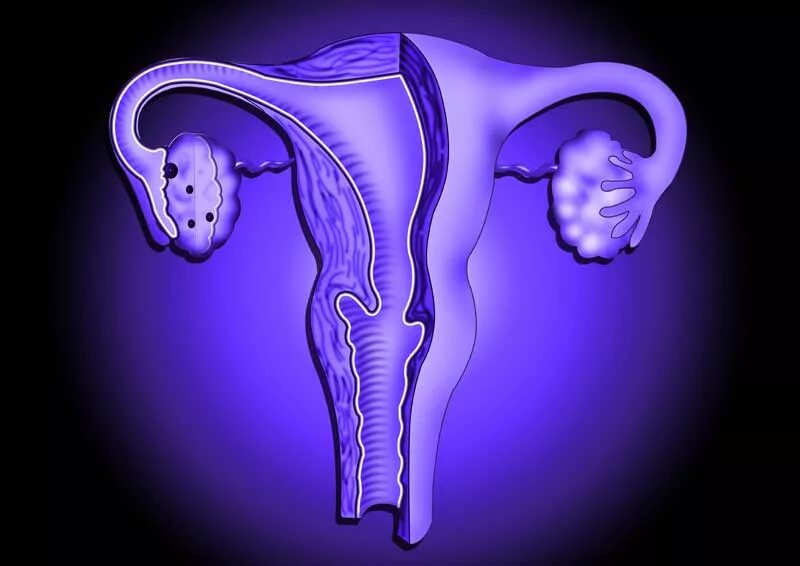 два женских органах. гистеросальпингография. два женских органах. двурогая седловидная матка. передняя спайка больших половых губ.