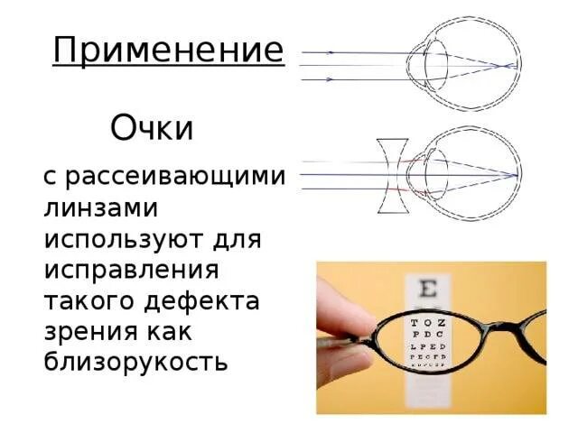 Очки для дальнозоркости линзы. Линзы для коррекции близорукости. Линзы очков для близоруких. Рассеивающая линза для миопии.