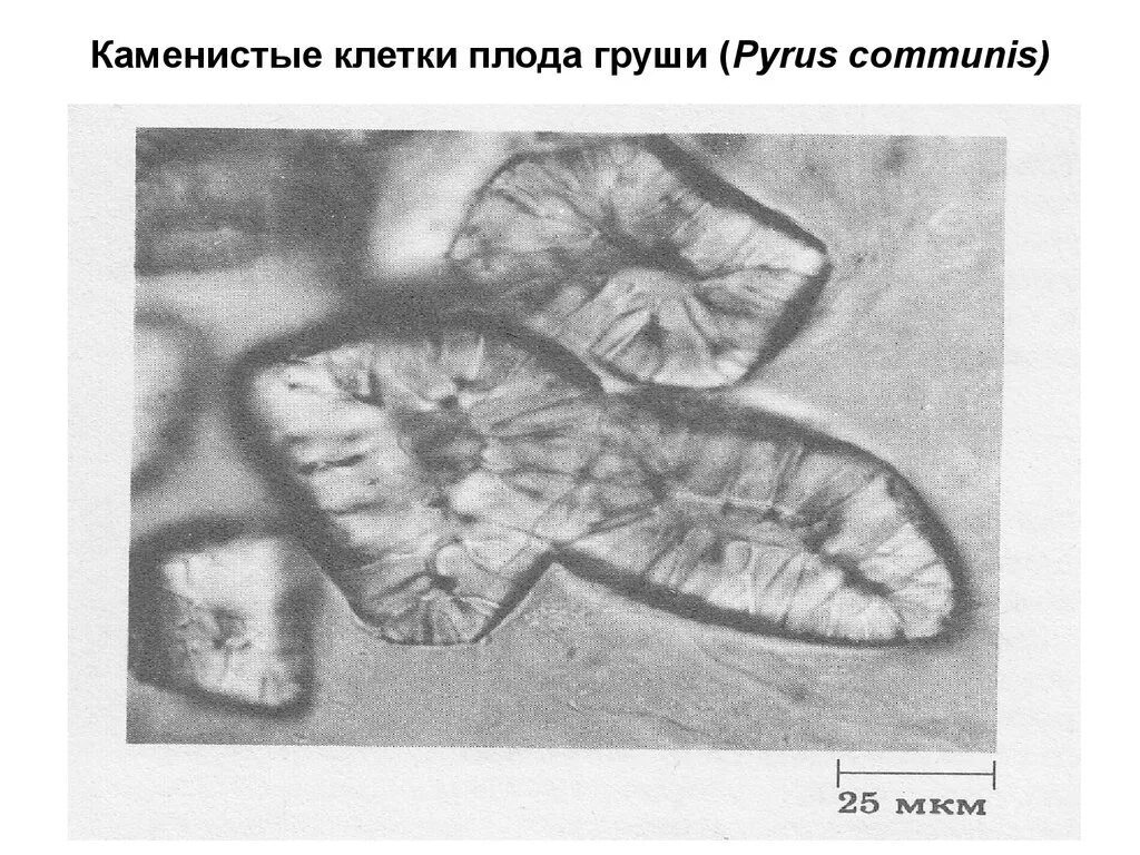 Клетка околоплодника. Склереиды груши. Склереиды клетки груши. Склереиды плода груши. Склереиды в мякоти плода груши.