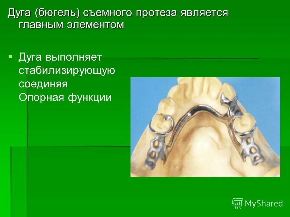 Нижняя дуга бюгельного протеза. Расположение дуги бюгельного протеза на верхней челюсти. ширина дуги бюгельного протеза на нижней челюсти. дуга бюгельного протеза. расположение дуги бюгельного протеза.