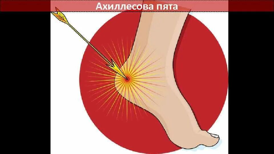 Ахиллесова пята античная мифология. Ахиллесова пята рисунок. Ahillesova Pyata. Ахиллесова пята пятка.