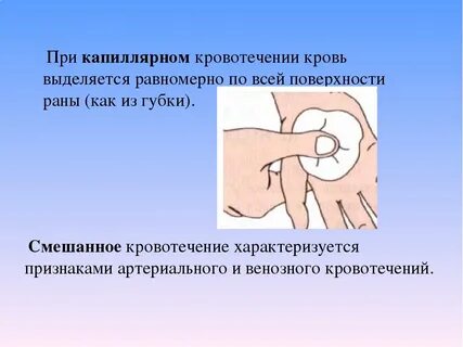 Правильный способ капиллярного кровотечения
