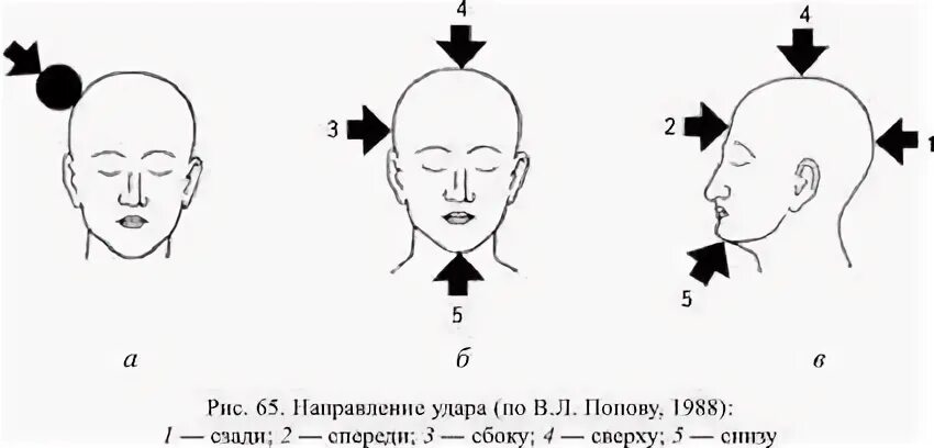 После удара головой болит голова