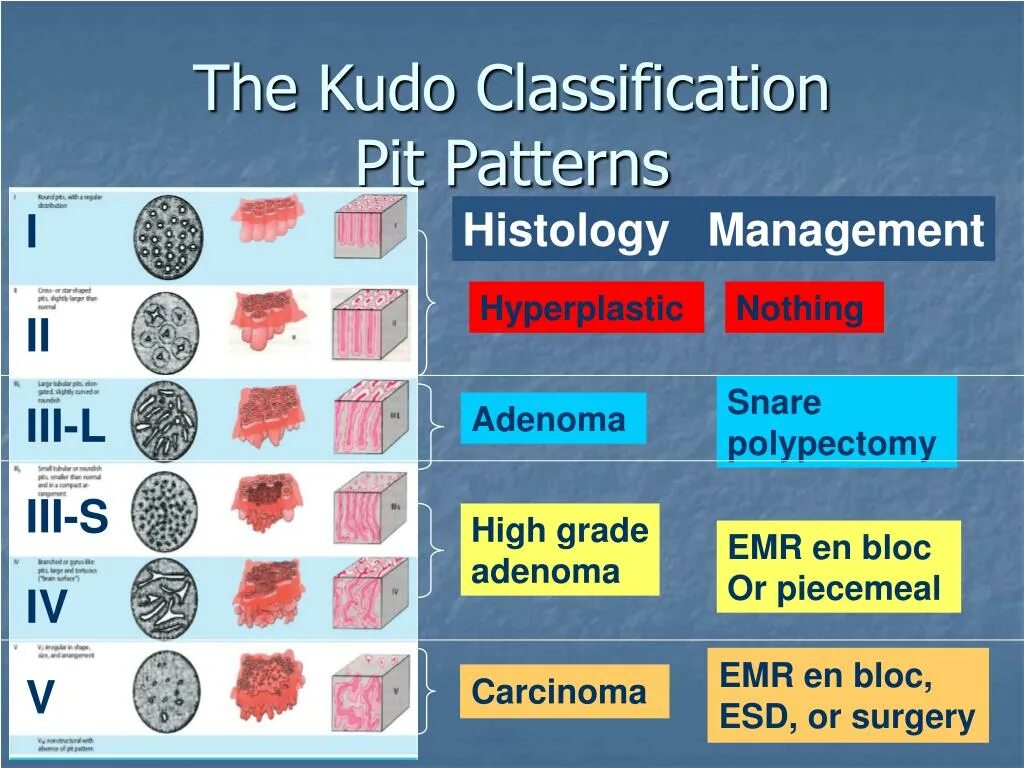 Тип 0 is. Kudo классификация полипов. Pit pattern классификация Kudo. Классификация Kudo. Kudo эндоскопия классификация.