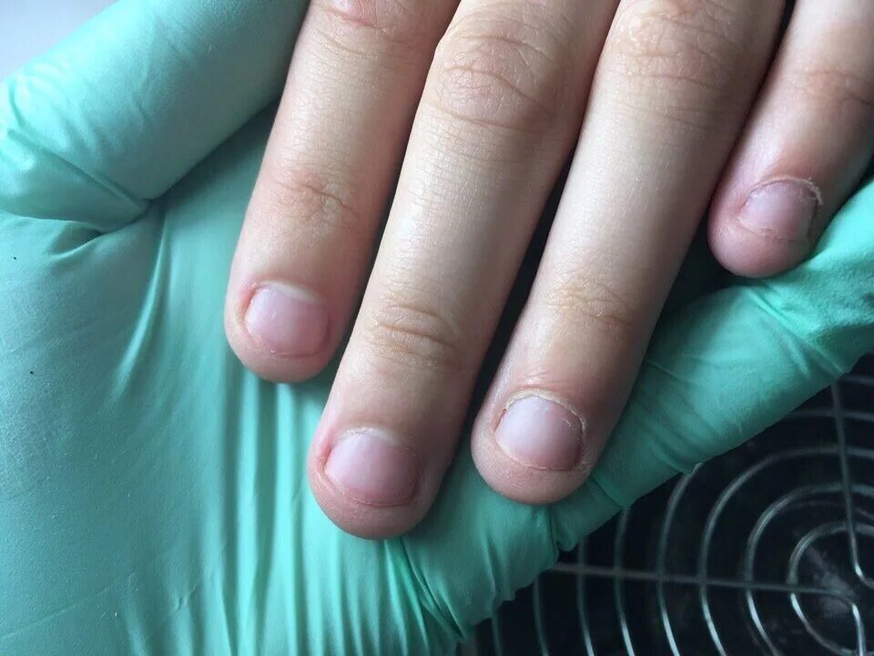 Ногти короткие. Короткие ногти с маленькой ногтевой пластиной. Короткая ногтевая поасти. Короткие и широкие ногти на руках. Ногти на маленькие пальцы