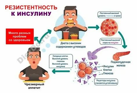 Гиперинсулинизм что это такое