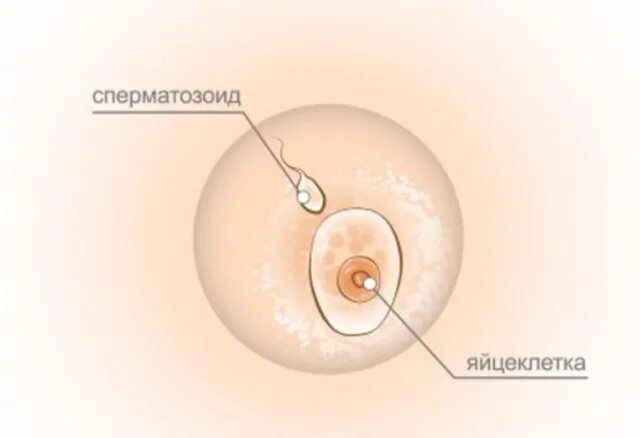 Красивые ореолы