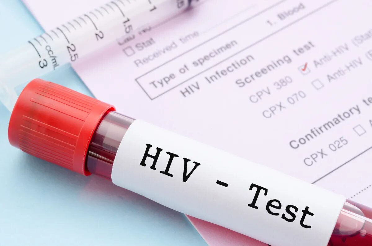Вич инфицированные тест. ВИЧ. ВИЧ пробирка. Тест на ВИЧ инфекцию.