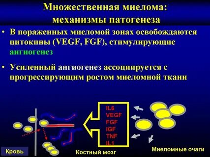 Формы множественной миеломы