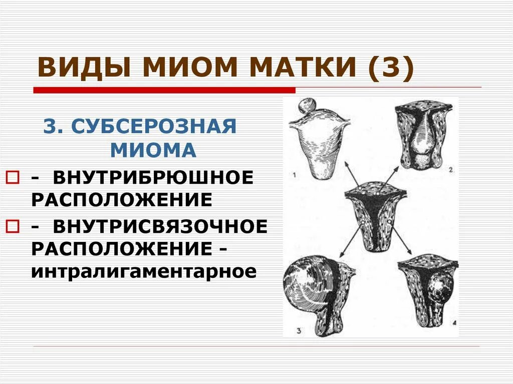 Тип матки человека. Тип матки человека