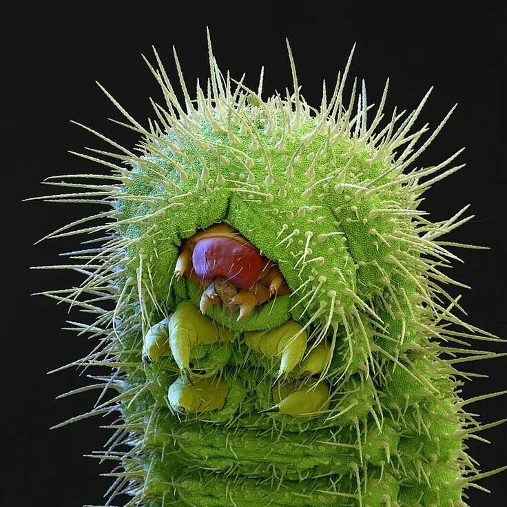 Bacteria and Fungus seen in the Scanning and Transmission Electron Microscope - 