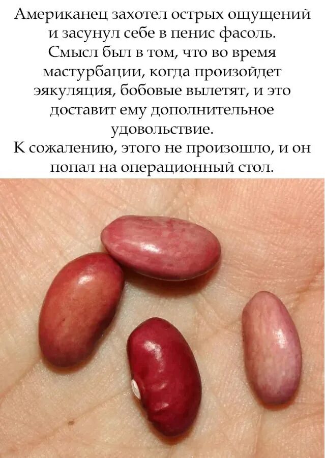 Семена фасоли могут длительно находиться в состоянии. Сухие семена фасоли. семена красной фасоли. разбухшая фасоль.