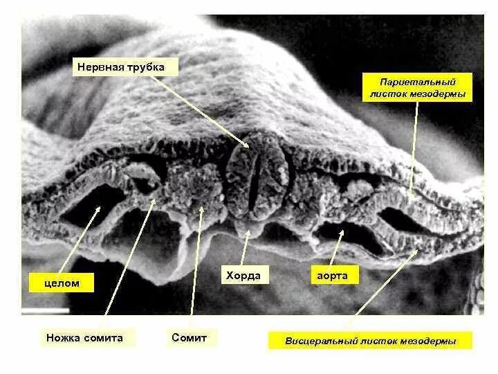 Сомиты и спланхнотом. Дифференцировка мезодермы гистология. Париетальный листок мезодермы. Париетальный листок спланхнотома мезодермы.