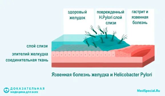 Хеликобактер как передается. Факторы патогенности h pylori. хеликобактер пилори гликокаликс. хеликобактер строение. факторы вирулентности хеликобактер пилори.