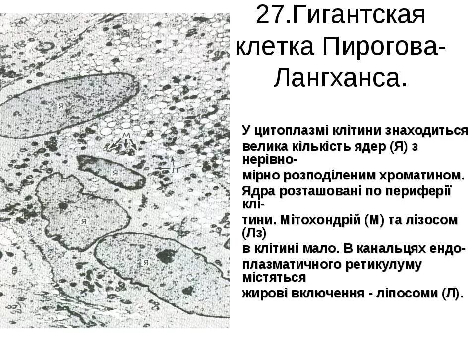 Клетка типа инородных тел. Клетка типа инородных тел