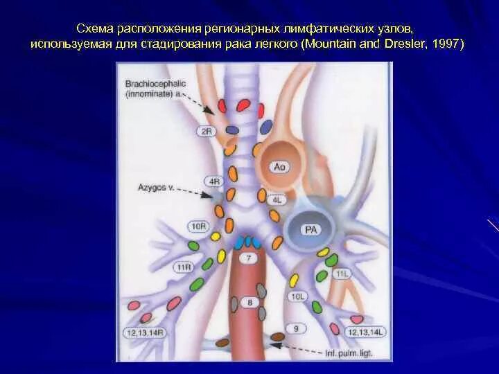 Метастазы лимфоузлы форум. Регионарные лимфатические узлы. Региональные лимфатические узлы легких. Регионарные лимфоузлы легкого. Легкие и регионарные лимфатические узлы.