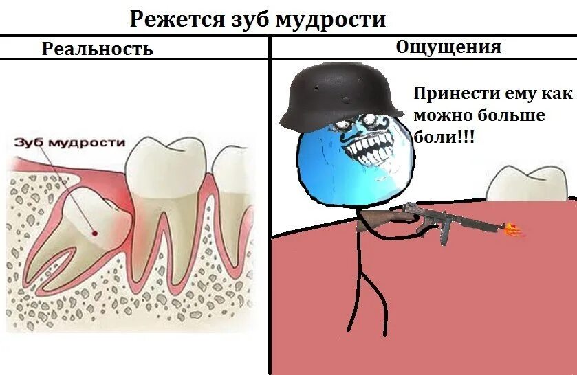 Смешные мемы про зубы мудрости.