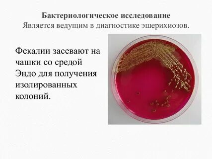 Escherichia в моче
