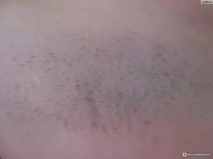 Эпиляция глубокого бикини видео у женщин