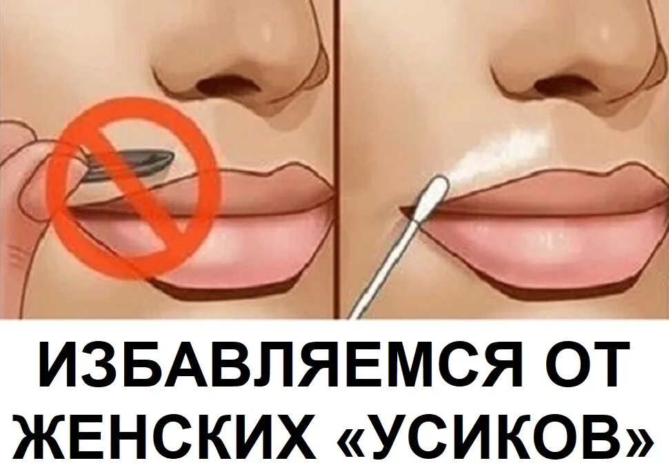 Как избавиться от женских усиков. Избавление от усиков навсегда. избавляемся от усиков в домашних. средство для убирания усиков. как избавиться от усов навсегда.