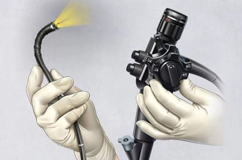 слизь в желудке при фгдс. слизь в желудке при фгдс. слизь в желудке при фгдс. слизь в желудке при фгдс. фгдс поверхностный гастрит заключение.