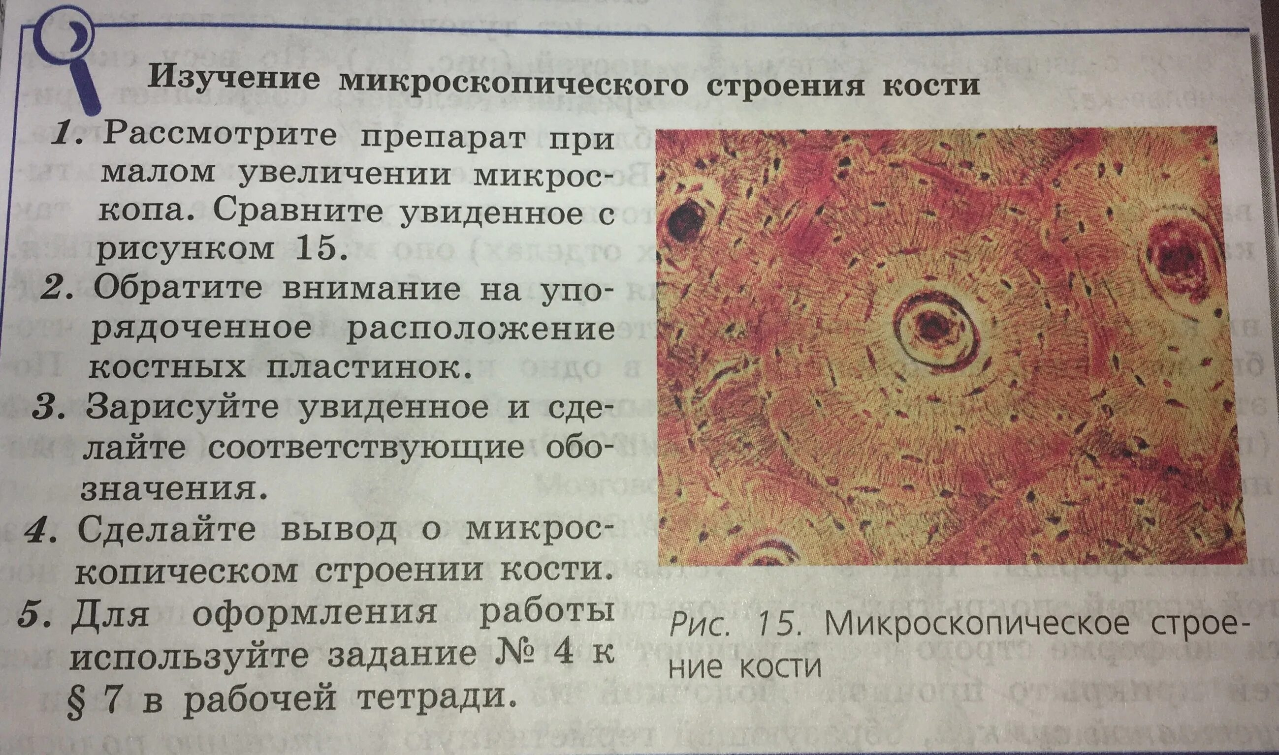 Лабораторная работа по простейшим 8 класс. Микроскопическое строение кости 8 класс биология. микроскопическое строение кости. лабораторная по биологии 8 класс микроскопическое строение кости. микроскопическое строение кости 8 класс.