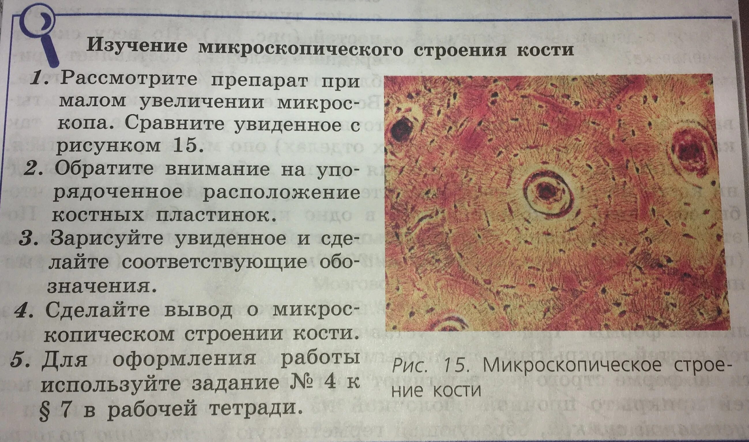 Ответы лабораторная работа по биологии 8. Микроскопическое строение кости 8 класс биология. Микроскопическое строение кости. Лабораторная по биологии 8 класс микроскопическое строение кости. Микроскопическое строение костей 8 класс.