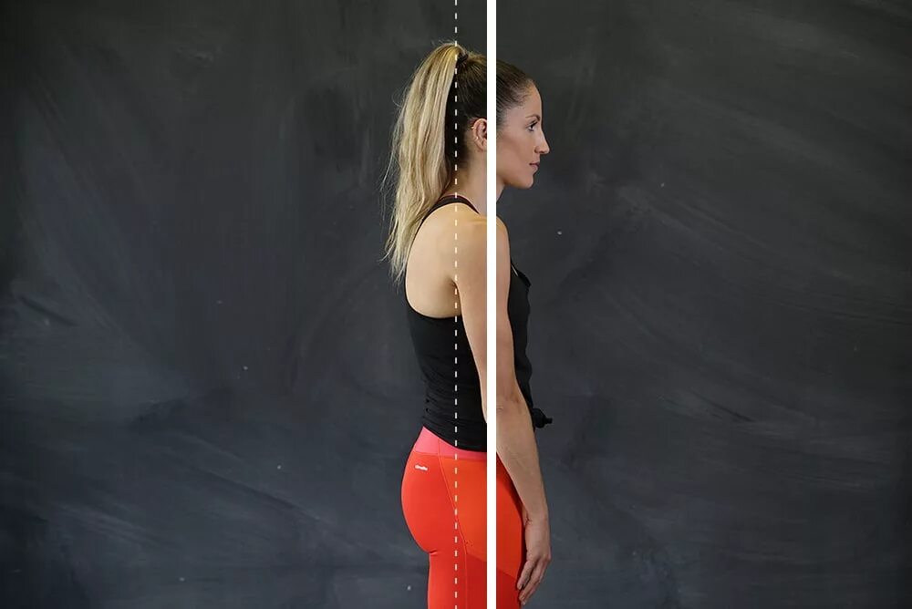 Round shouldered. Скругления плеч. исправление скруглённых плеч. round shoulders. скругленные плечи спереди.