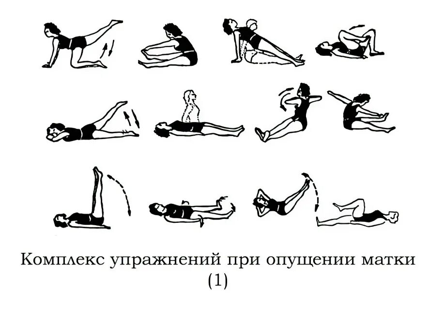 Опущение стенок матки упражнения. Гимнастика кегеля для женщин при опущении матки. Опущение матки лечебная гимнастика. Упражнение кегеля для женщин для укрепления мышц матки при опущении. Операция опущение матки лечение