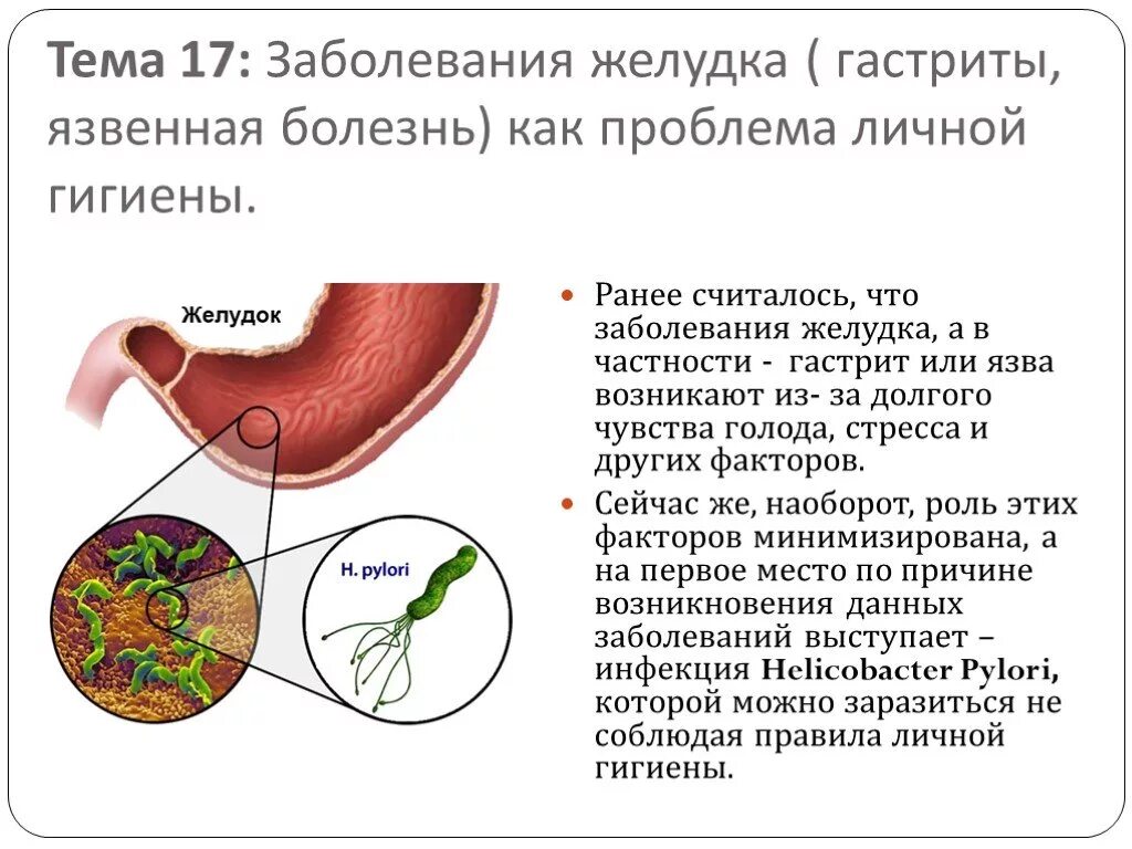 Кислотность желудка язва желудка. Профилактика язвенной болезни двенадцатиперстной кишки. Памятка для пациента с язвенной болезнью желудка. Памятка гастритов и язвенной болезни. Болезни желудка гастрит и язвенная болезнь.