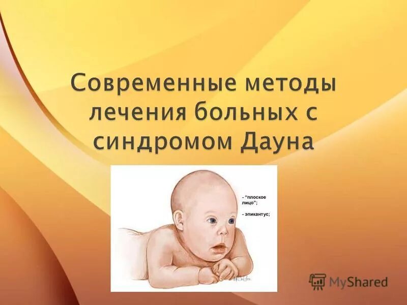синдром дауна лечится. синдром дауна лечится. синдром дауна лечится. лечение синдрома дауна у детей. синдром дауна.