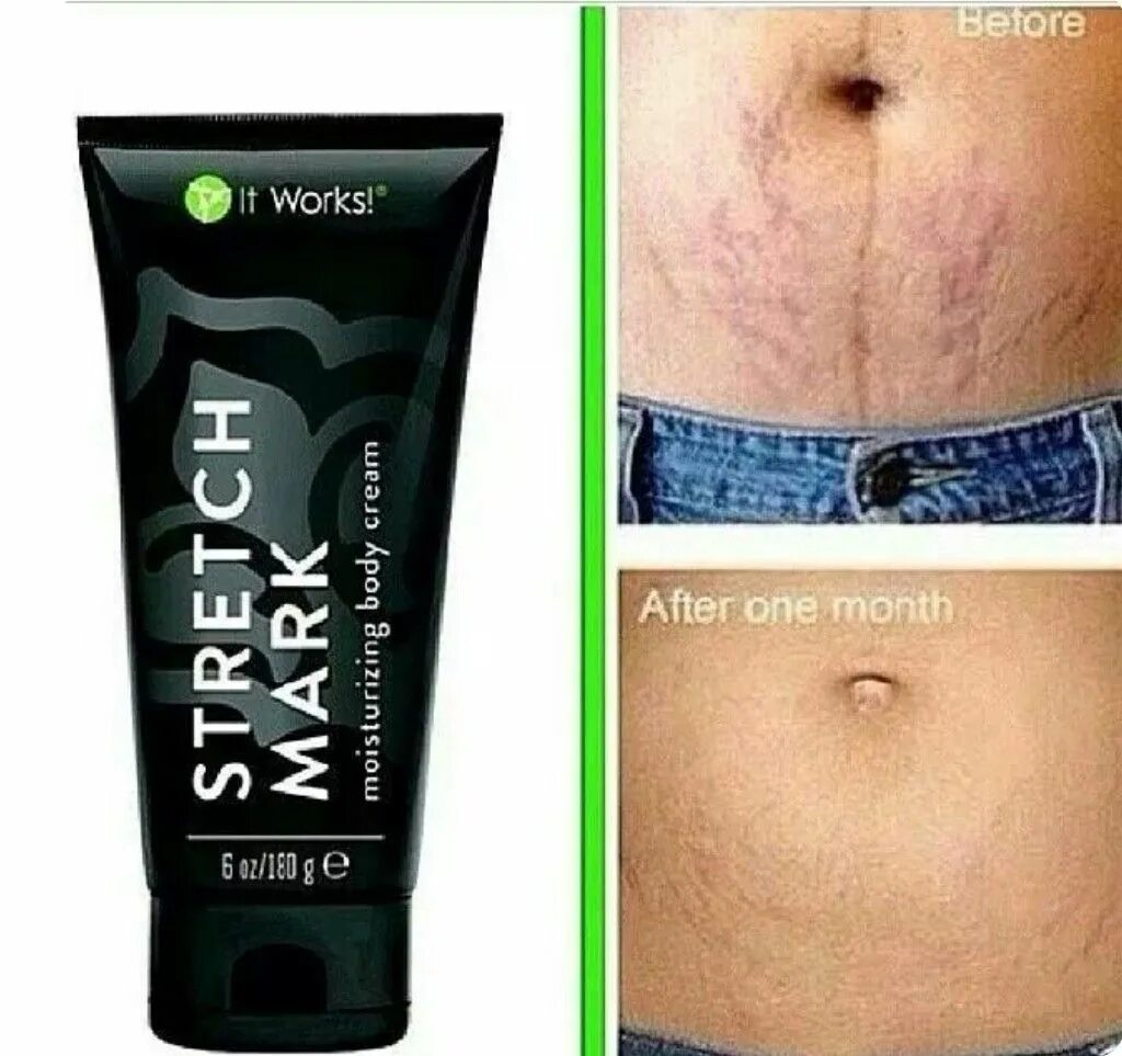 Stretch mark cream. Крем от растяжек stretch Marks Cream. Stretch Marks Cream 100% .натурал от растяжек. Японский крем от растяжек.