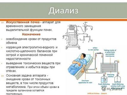 Схема искусственной