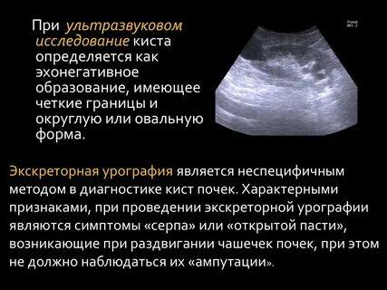 Узи почек поджелудочной