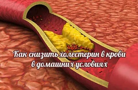 Холестерин форум