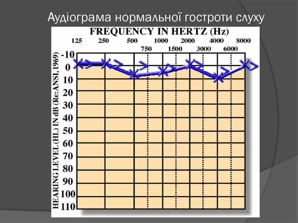 Аудиограмма норма. Аудиометрия слуха график норма. Аудиограмма возрастная норма. Аудиометрия, возрастные. Бланк аудиограммы.