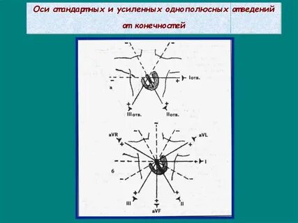 Ось стандартная