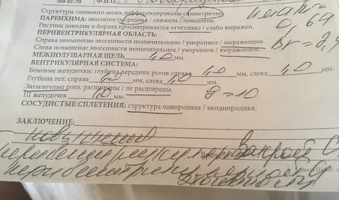 Нейросонография у взрослых