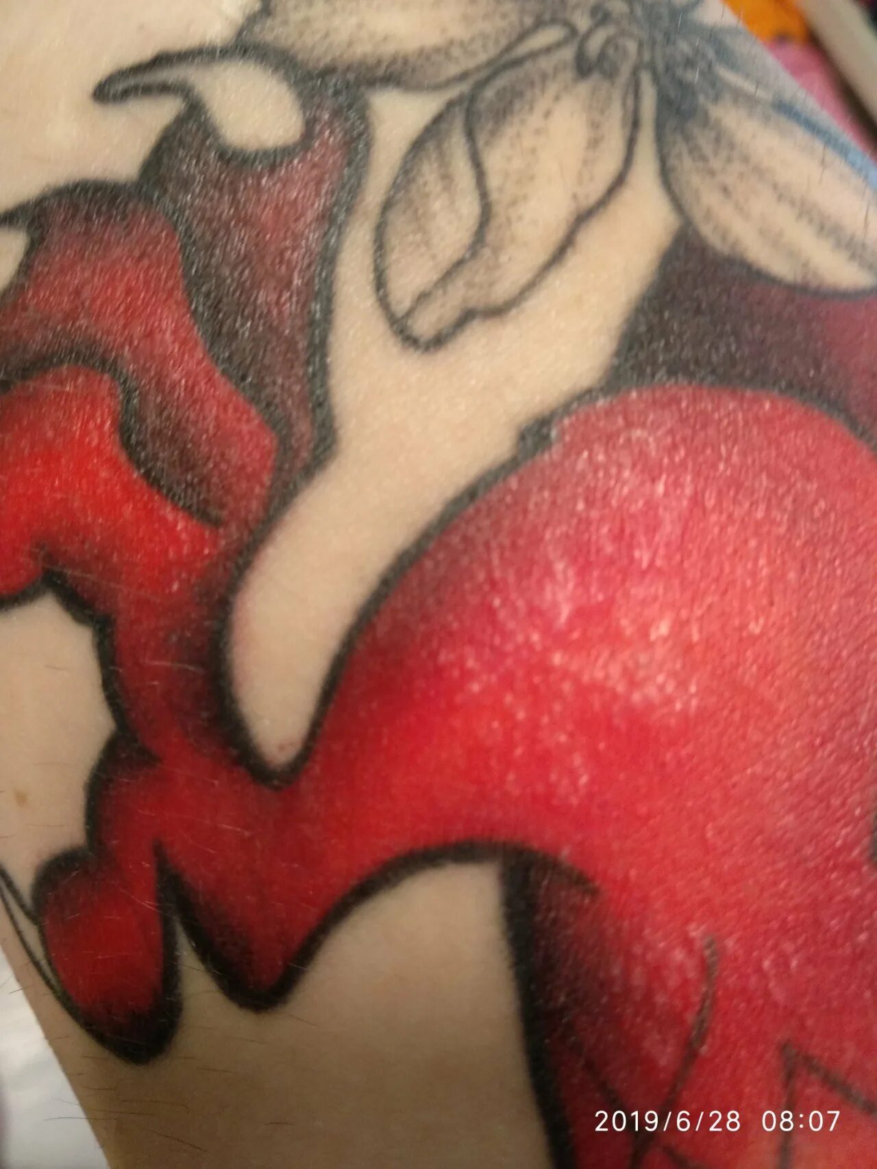 Прыщи на татуировке. Прыщи на татуировке. Прыщи на татуировке. Прыщи на татуировке. Прыщи на татуировке.