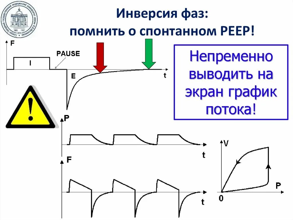 Кривая инверсии. Кривая доходности облигаций сша. Инверсия кривой доходности американских облигаций график. Инверсия графика функции. Инвертированная кривая доходности.