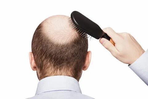 Hair loss