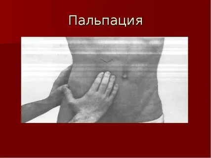 Пальпация почек