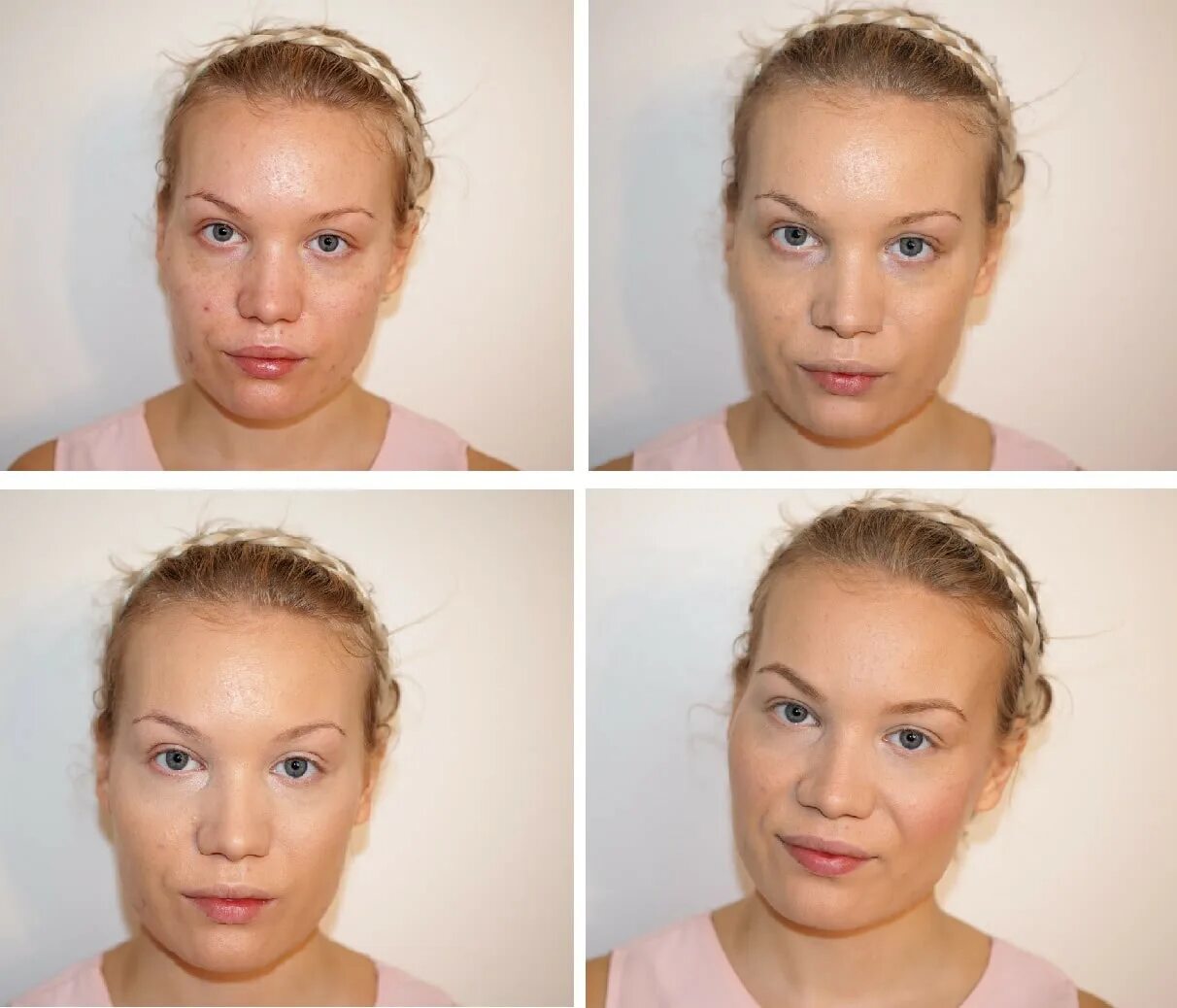 Фулл фейс что это. Full face процедура. фул фейс лифт что это. фулл фейс до после. фулл фейс до после круглое лицо.